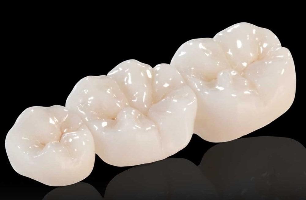 Циркониевые коронки – космический материал для ваших зубов