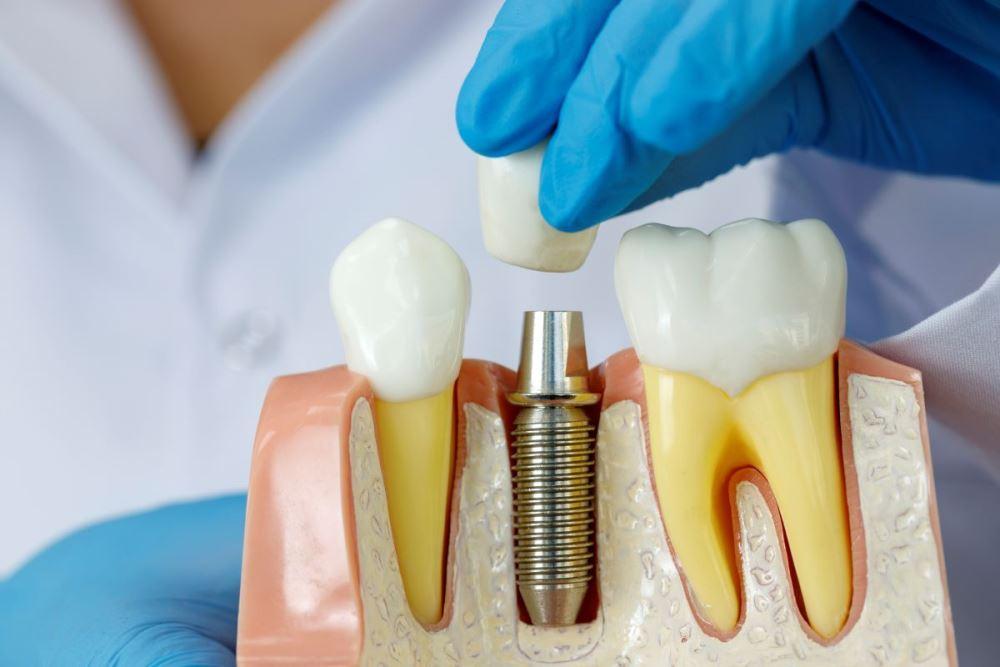 Отзывы о стоматологических клиниках Новосибирска помогут сориентироваться